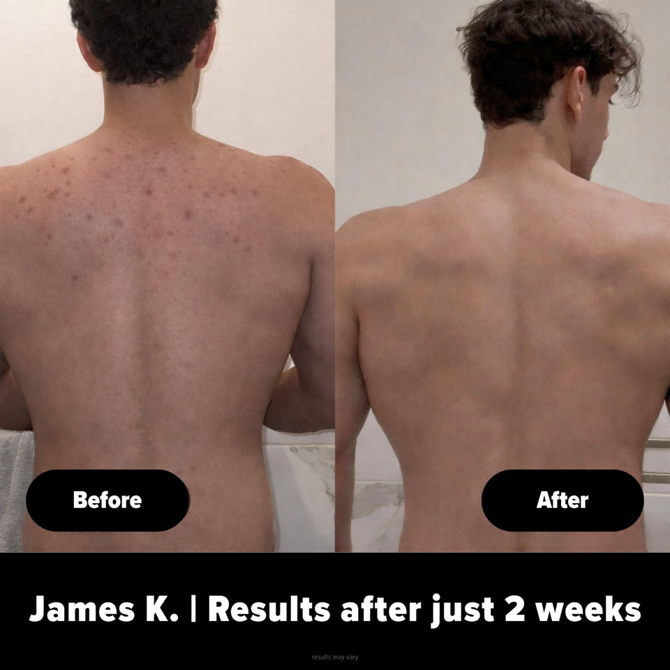 Body Buffer