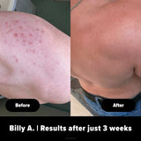 Body Buffer