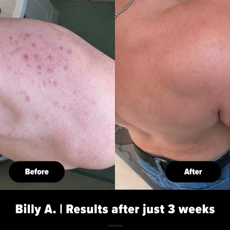 Body Buffer